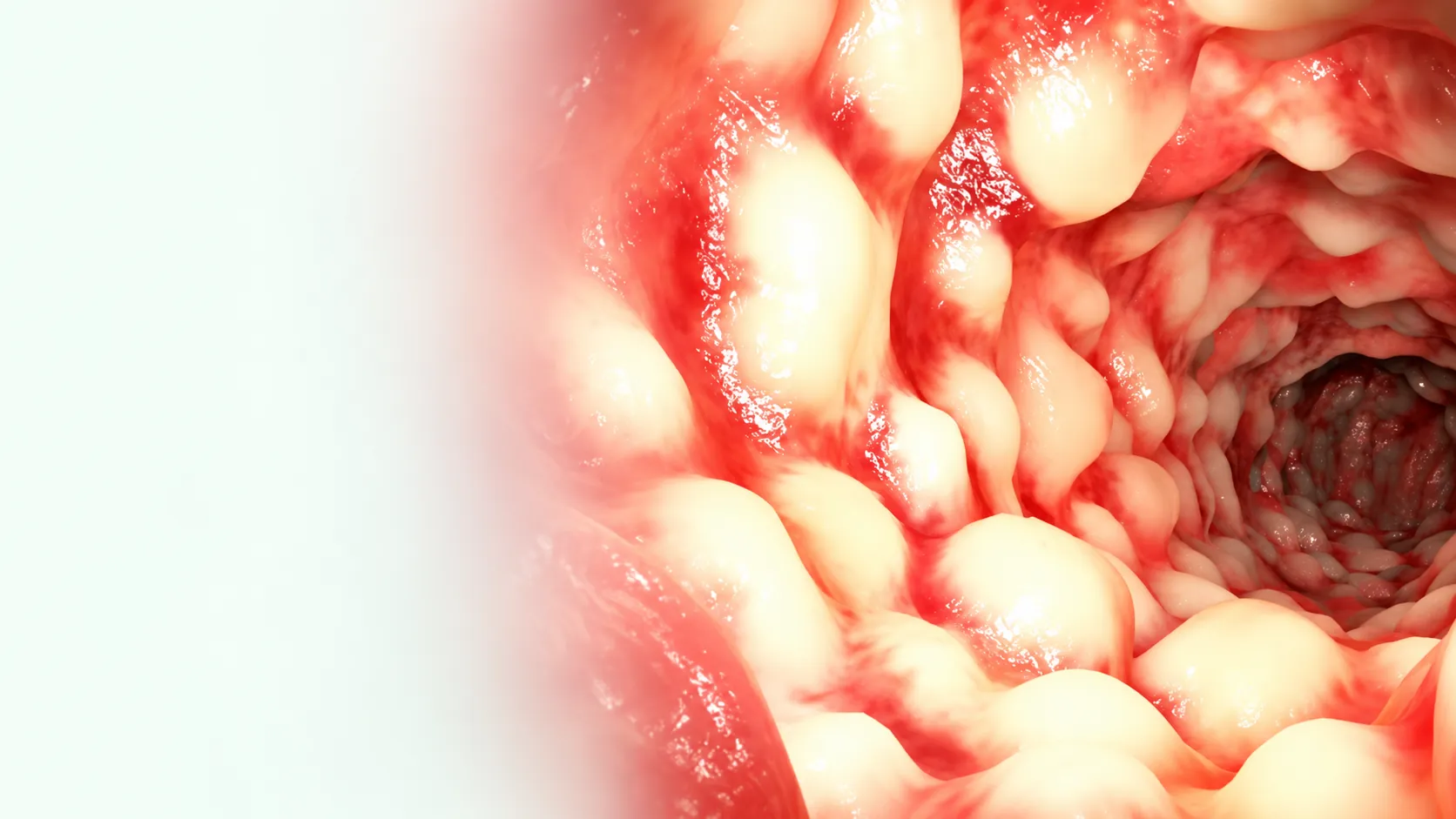 Ilustración del lumen intestinal y sus pliegues mucosos