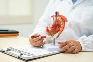 A female doctor a hospital desk discussing digestive disorders such as stomach ulcers,acid reflux