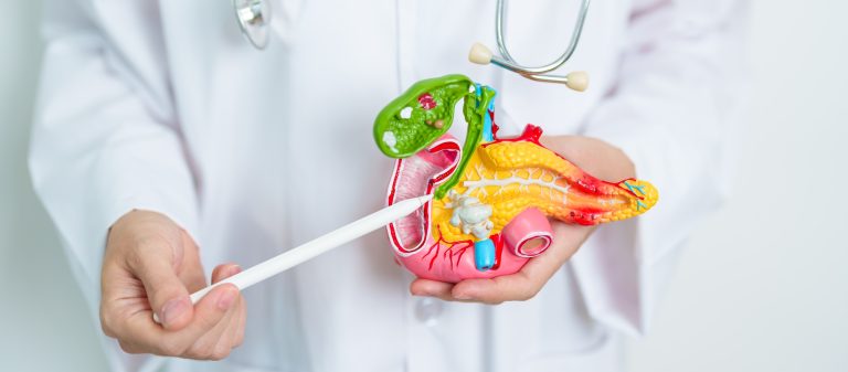 Doctor with human Pancreatitis anatomy model with Pancreas