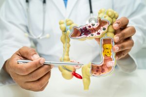 Intestine, appendix and digestive system, doctor holding anatomy model for study diagnosis