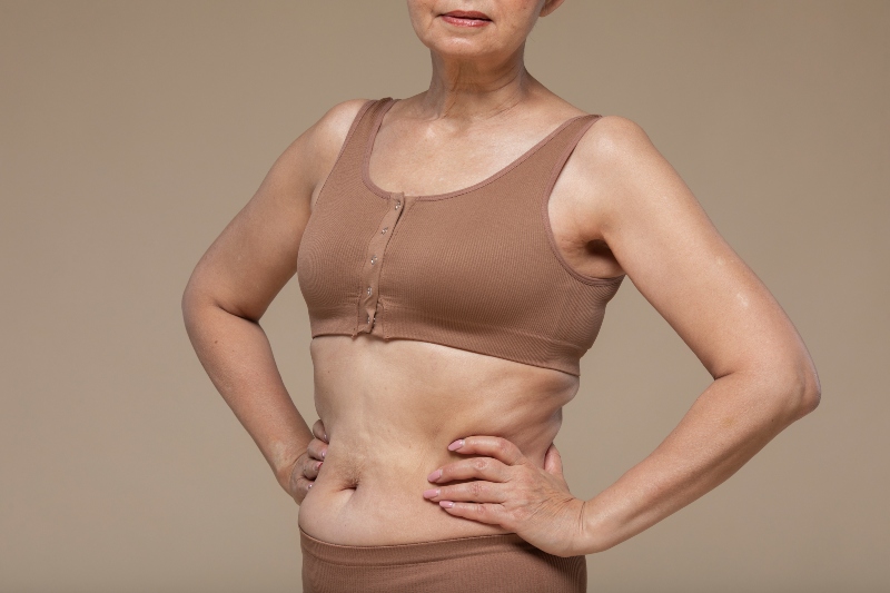 Diástasis Abdominal