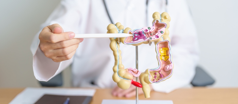 Patología Colorrectal