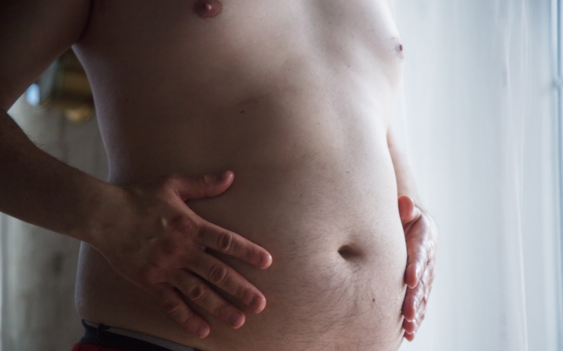 Hernias Abdominales