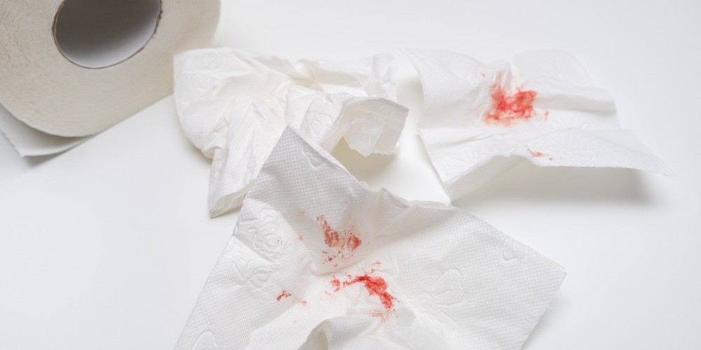 Sangrado anal en papel higiénico como señal de alarma digestiva