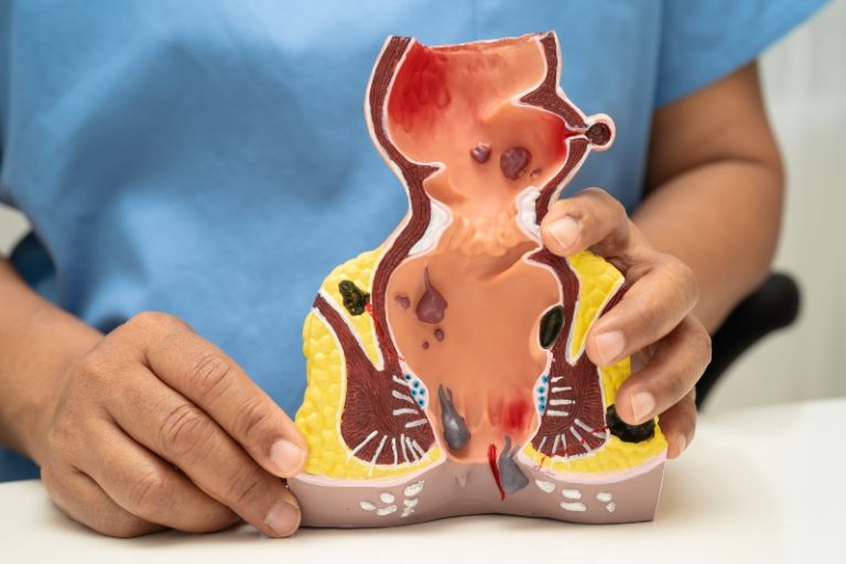 Guía Completa sobre la Patología del Suelo Pélvico